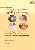 نسخه  های کاربردی بیماری  های پوست، مو و ناخن